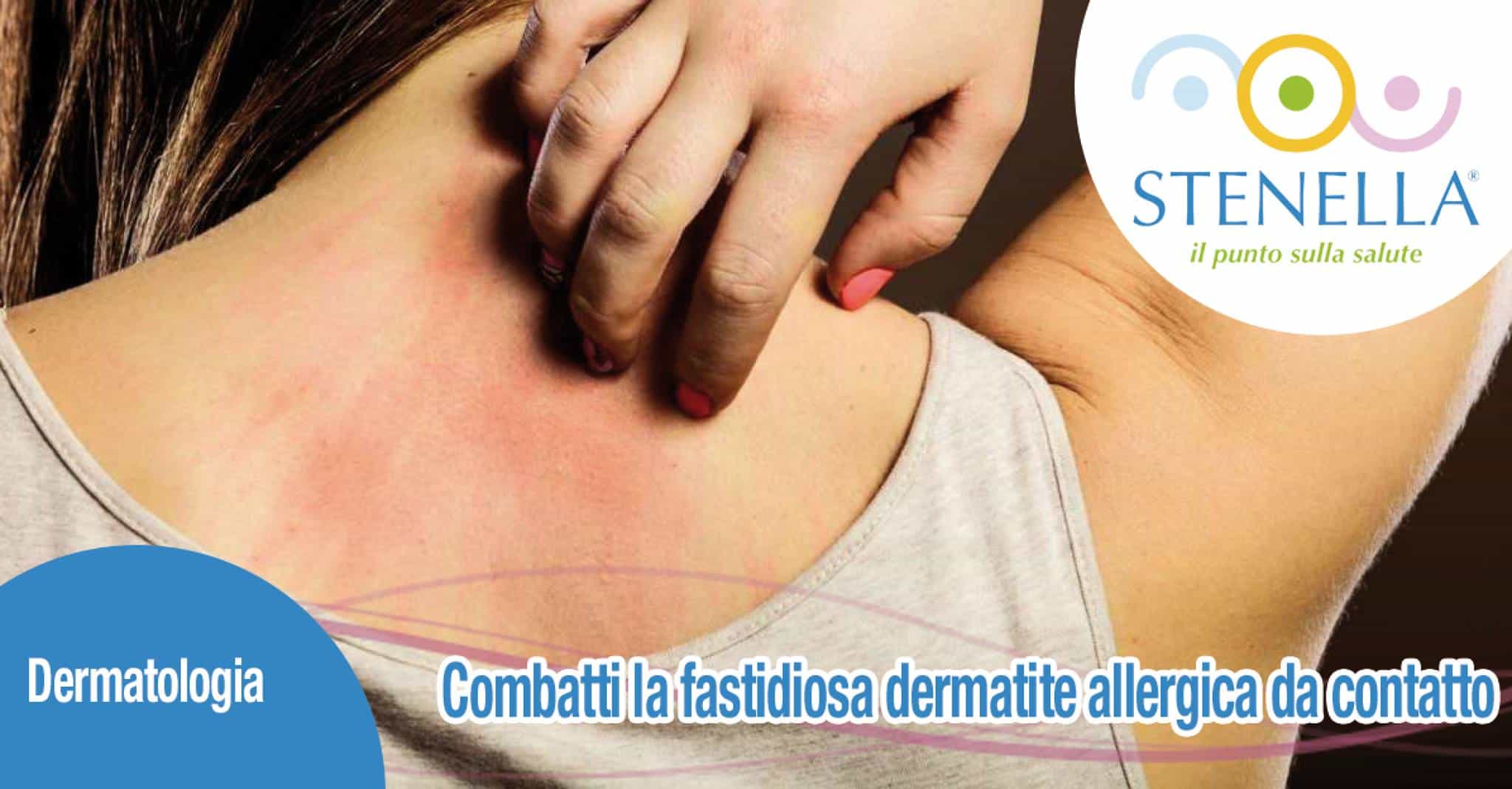 dermatite allergica da contatto