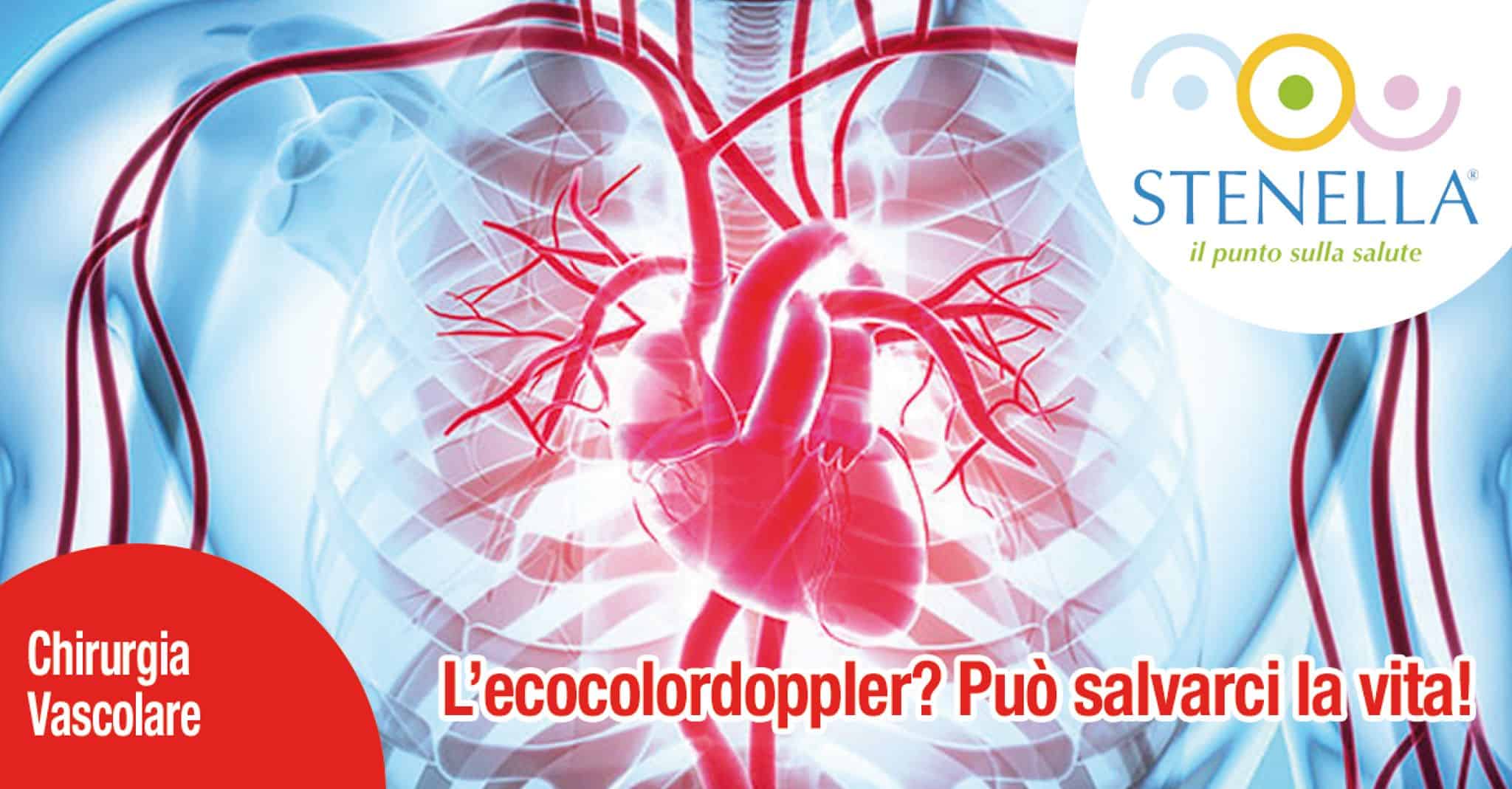 ecocolordoppler